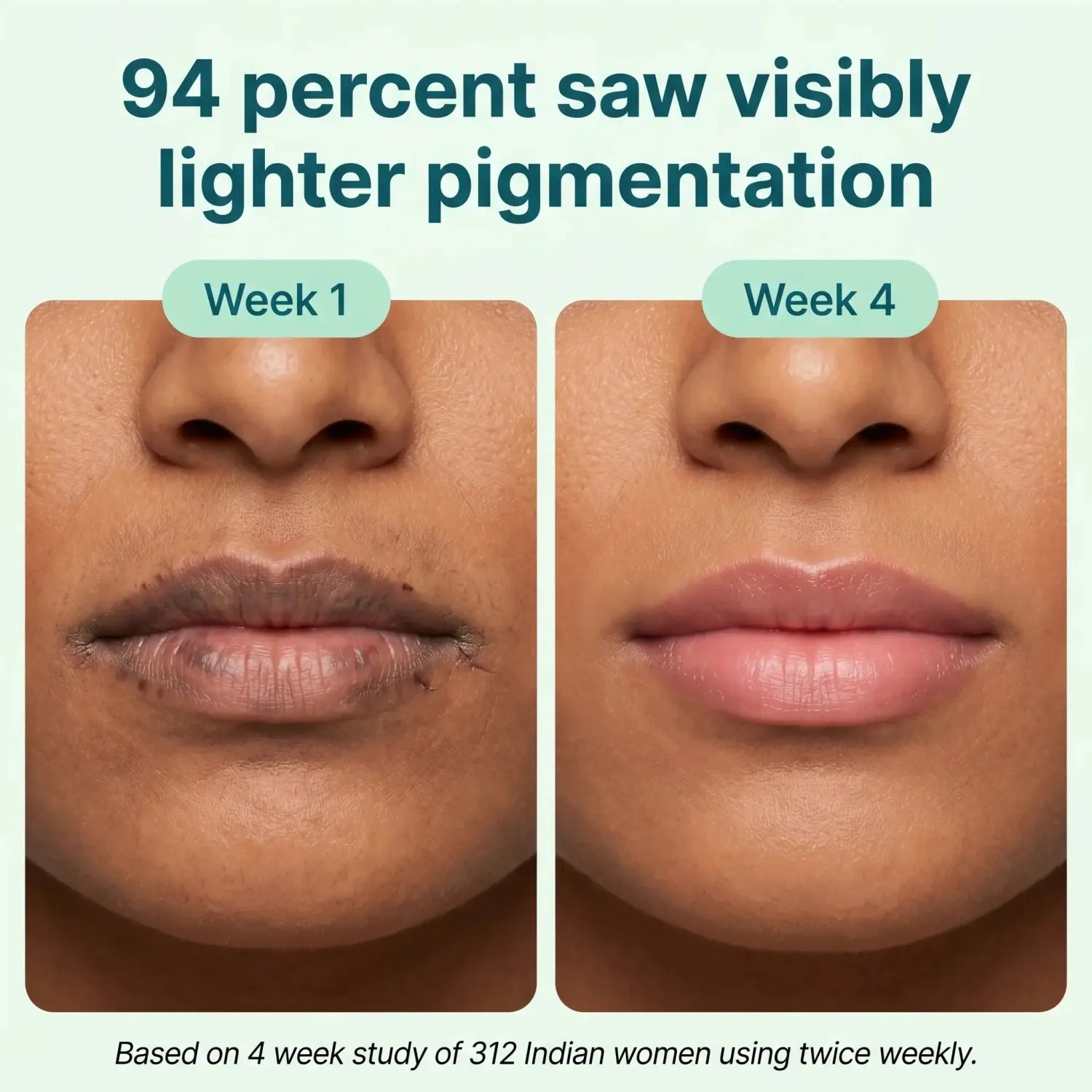 Lips week 1 vs week 4