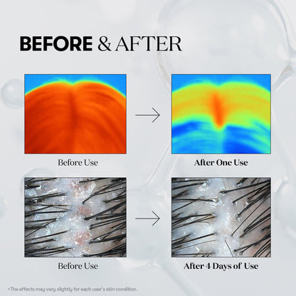 PDRN Reedle Shot Hair Ampoule 100dl