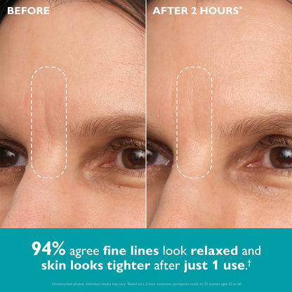 Lumiri Peptide Skinjection — Eye & Wrinkle Tape