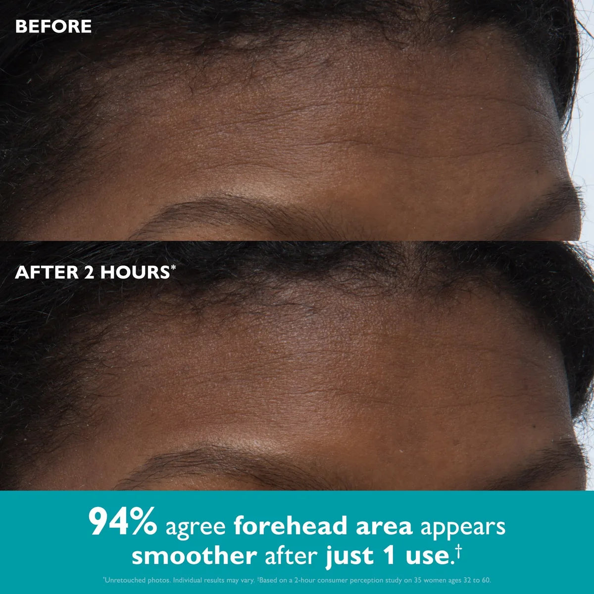 lumiri_eye_tape_04_before_after_forehead.webp