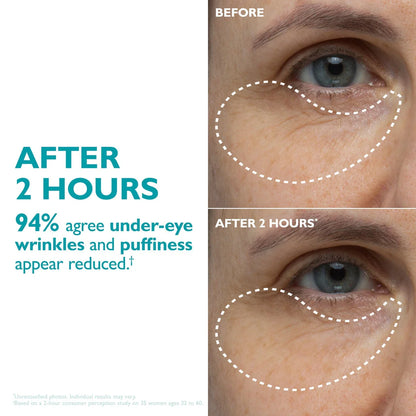 Lumiri Peptide Skinjection — Eye & Wrinkle Tape