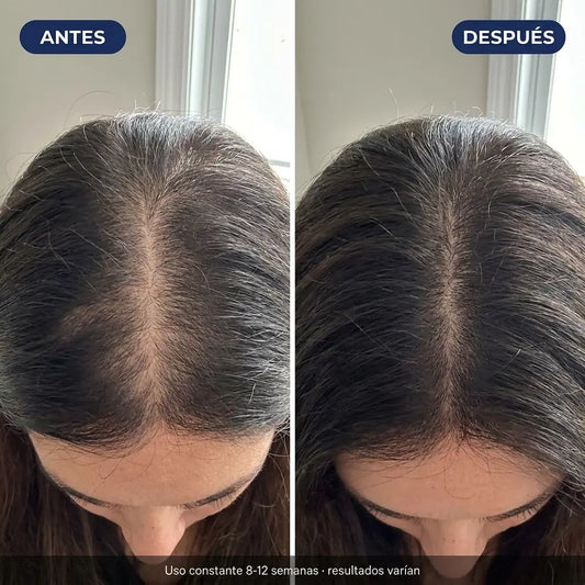 Lumiri Deoxyribose Scalp Serum